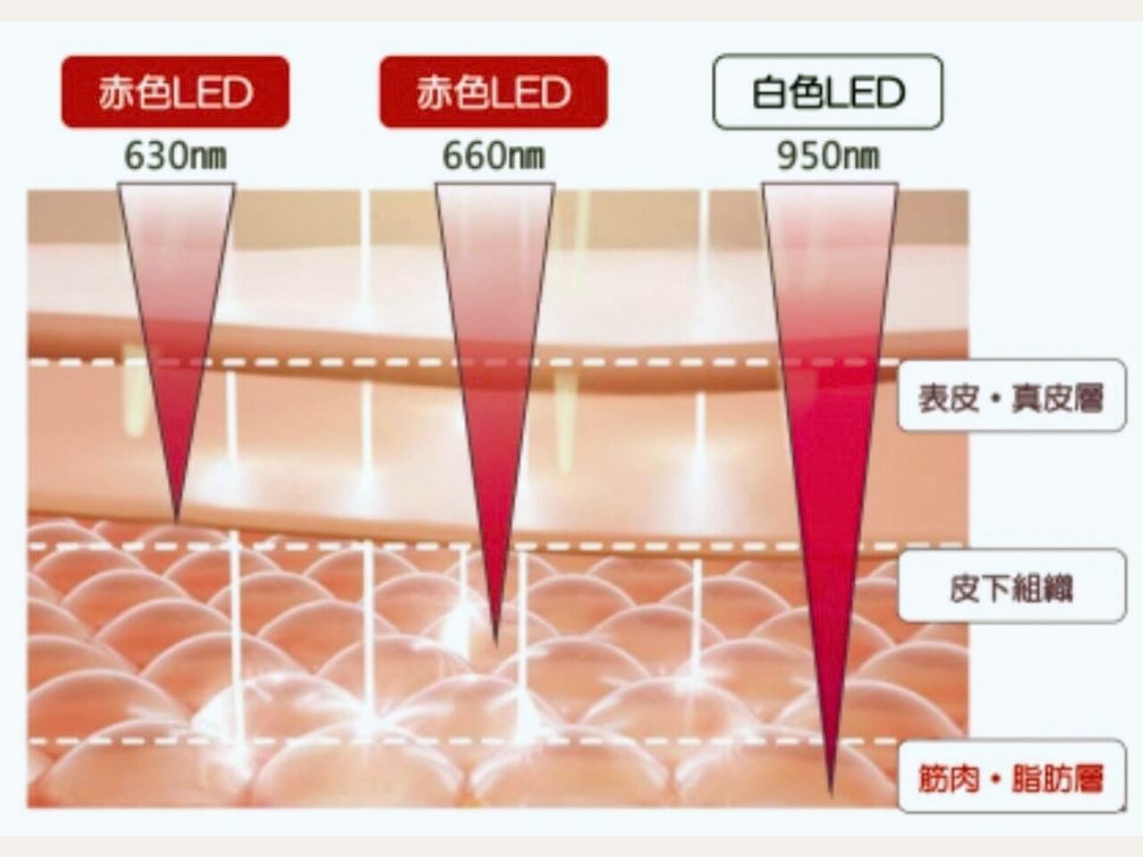 身体に近赤外線LEDを照射するイメージ